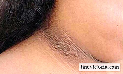 Reduzir o escurecimento da pele do pescoço