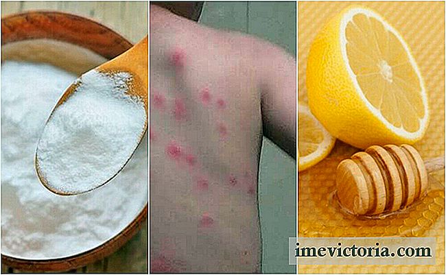 Facilidade picadas de pulgas com estes 5 remédios naturais
