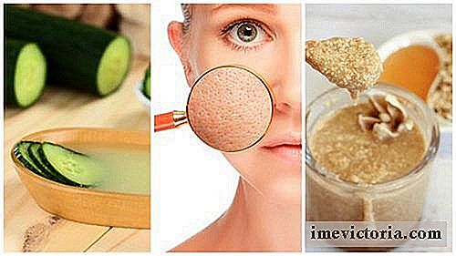 Etanșează porii pielii cu aceste remedii naturale 5