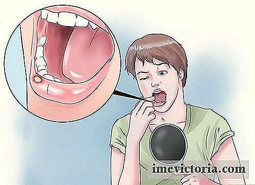 8 Remédios naturais para tratar úlceras na boca