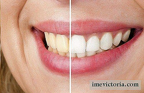 5 Přírodní tipy, které tvoří bělení zubů