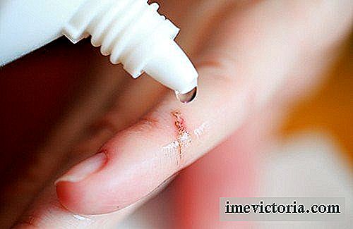 Cómo tratar una lesión para evitar cicatrices