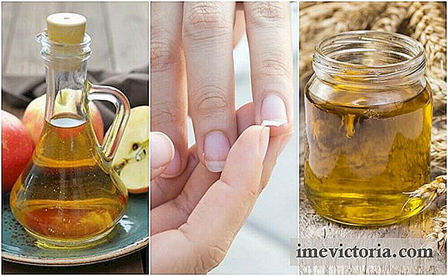 A fin de fortalecer las uñas quebradizas con estos 5 remedios caseros