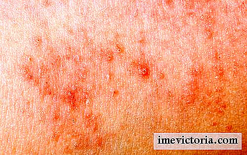 10 Nejběžnějších alergií na kůži