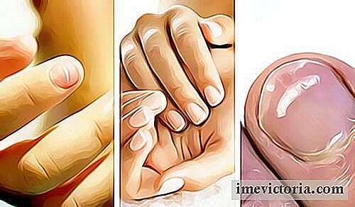 5 Známky špatného zdraví viditelné na nehty