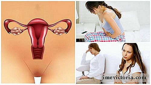 7 Ting du bør vite om ovariesyndrom polycystisk