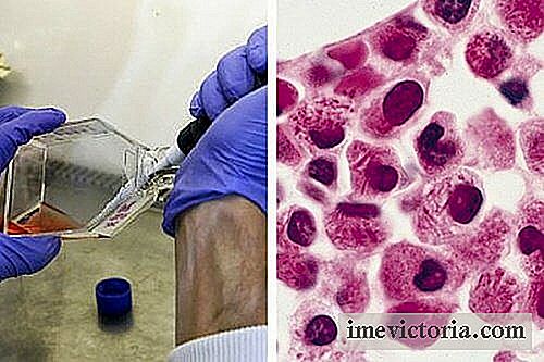 Videnskabelige gruppe finder system til at dræbe leukæmiske celler