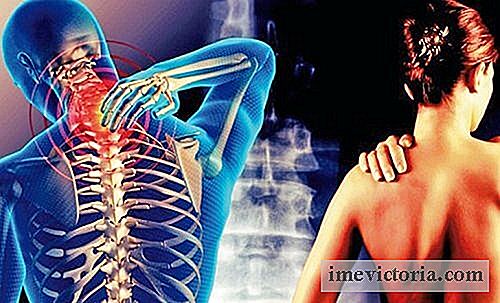Den cervicobrachialgie: denne smerte, der starter fra halsen til armen