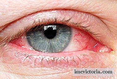 Glaucoma: ¿Cuándo ocurre y cómo evitarlo?