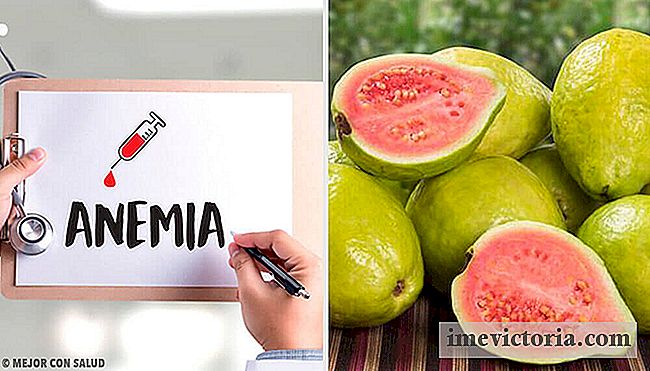 Guava: características y 5 beneficios increíbles
