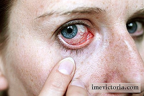 Hvordan å stoppe øynetørhet og rødhet?