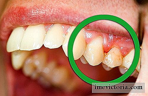 Sådan behandler de vigtigste sygdomme i munden