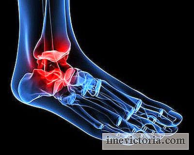 artroza kotníku otok frecarea articulațiilor cu durere în picioare