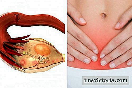 Cáncer de ovario: 7 señales que pueden revelar al asesino silencioso