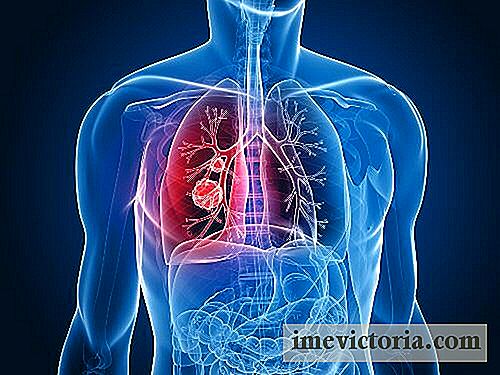 9 Signos de cáncer de pulmón que debe saber