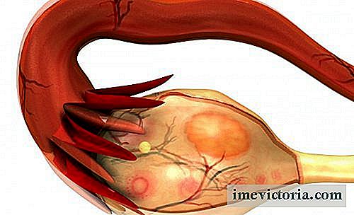 Para identificar el síndrome de ovario poliquístico (SOP)