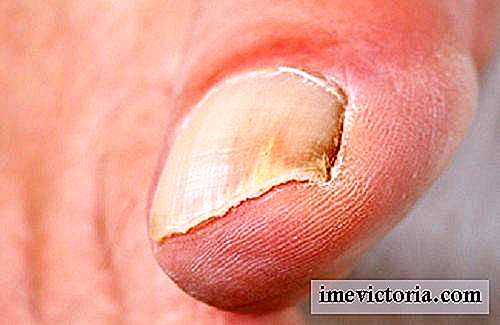 Tratamiento de las principales enfermedades de las uñas
