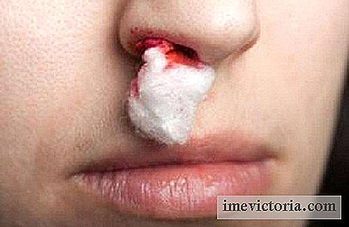 Co dělat v případě krvácení z nosu