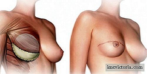 Qué se debe saber antes de una mastectomía