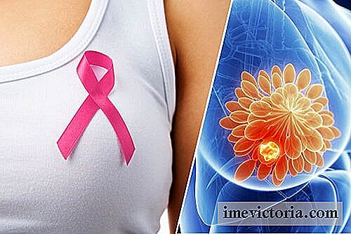 10 Tecken som kan tyda på bröstcancer