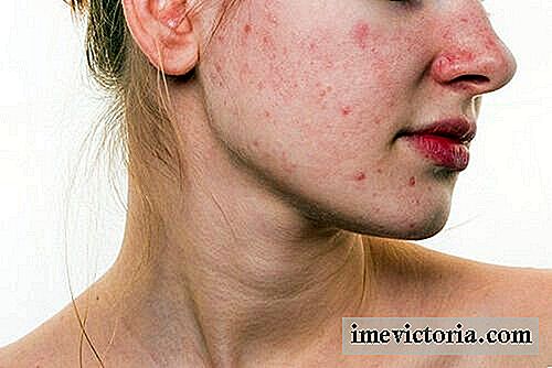 5 Vaner, der kan ødelægge dit ansigt