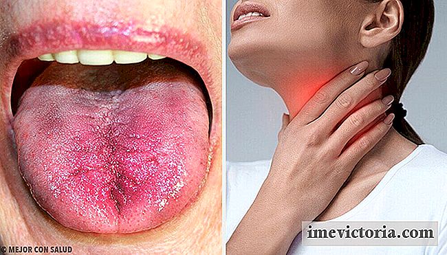 6 Maneras de saber si usted placas en la garganta