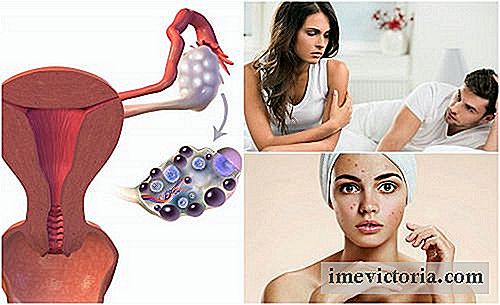 7 Síntomas de síndrome de ovario poliquístico que no se deben pasar por alto