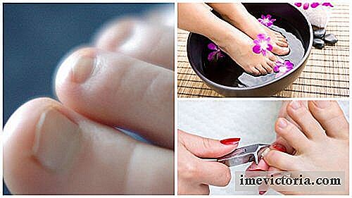 7 Saker att veta om nagelsvamp