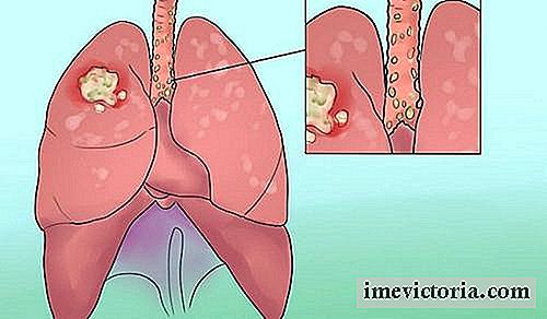 8 Sorprendentes signos de cáncer de pulmón que se contará con