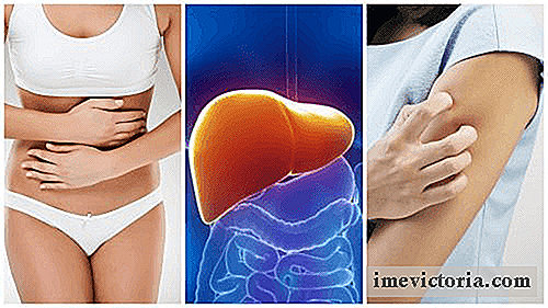 8 Síntomas que aquejan cuando el hígado está sobrecargado con toxinas