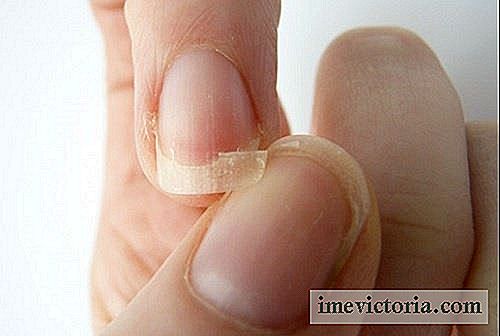 9 Causas de uñas quebradizas