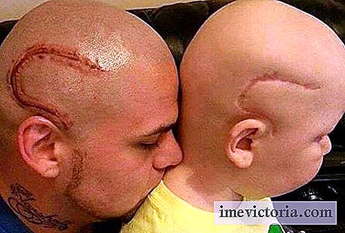 En far tatoverede hans søns ar, opereret på en kræft