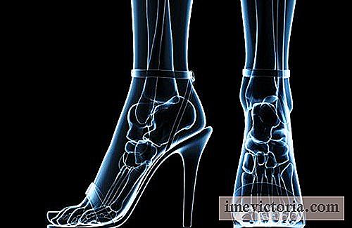 Misbruk av hæler: helsekonsekvenser