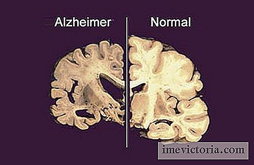 Alzheimer er forbundet med manglende søvn