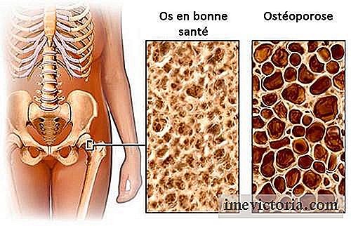Kostlægning for at undgå osteoporose