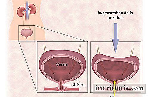 ØVelser for urininkontinens hos kvinder