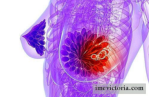 Jak odhalit časné rakoviny prsu? Rakovina
