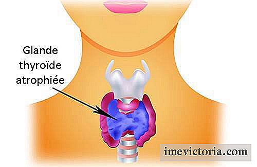 Hipotiroidismo: cómo cuidar su tiroides