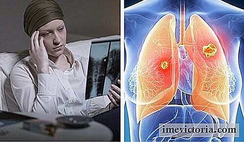 Lungekreft er mye dødelig hos kvinner