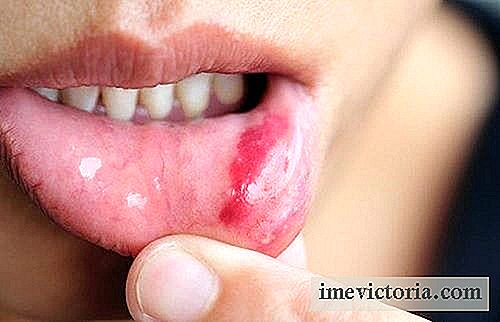 Cáncer de boca: síntomas, factores de riesgo y prevención