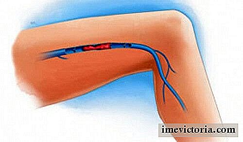 Mezi příznaky žilní trombózy v nohou