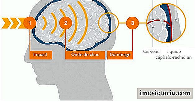 ¿Qué impacto tienen los golpes de luz en el cerebro?