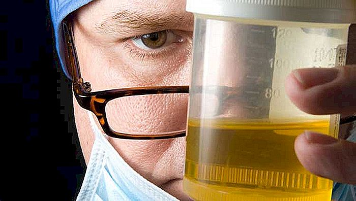 Årsager til urin med stærk smelte