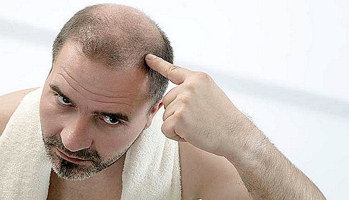 Ztráta vlasů - příčiny a léčba