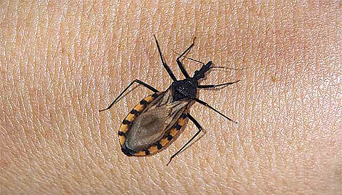 Chagasová nemoc - přenos, příznaky a léčba
