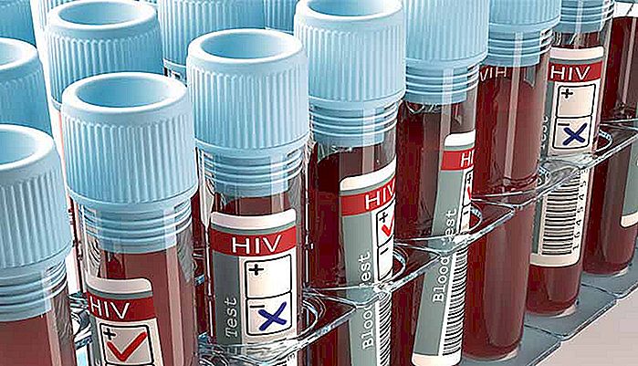HIV TEST - Jak vědět, jestli mám HIV