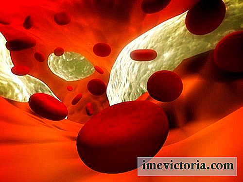 12 Přírodní prostředky k předcházení arterioskleróze