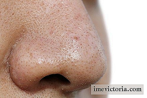 5 Ansigtsmasker mod hudorme