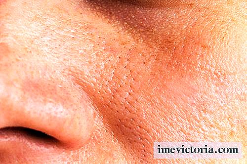 5 Naturlige løsninger for å redusere forstørrede porer i huden