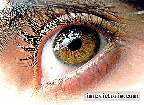 5 Remedies for tørt øjesyndrom